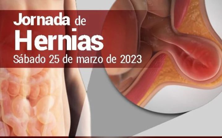 CON CIRUGIA DE HERNIAS INGUINALES LOS PACIENTES RECUPERAN CALIDAD DE VIDA
